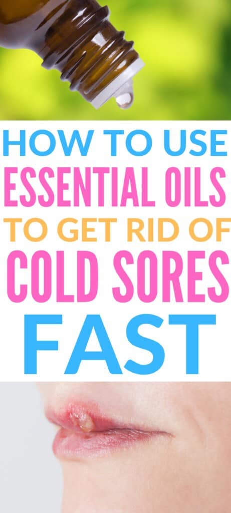 How to get rid of cold sores quickly using essential oils #coldsoreremedy